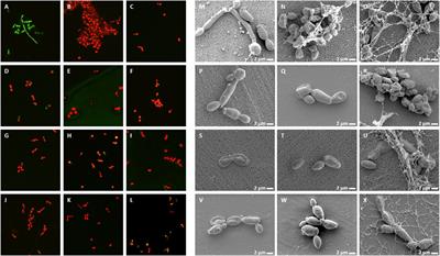 Legume Plant Peptides as Sources of Novel Antimicrobial Molecules Against Human Pathogens